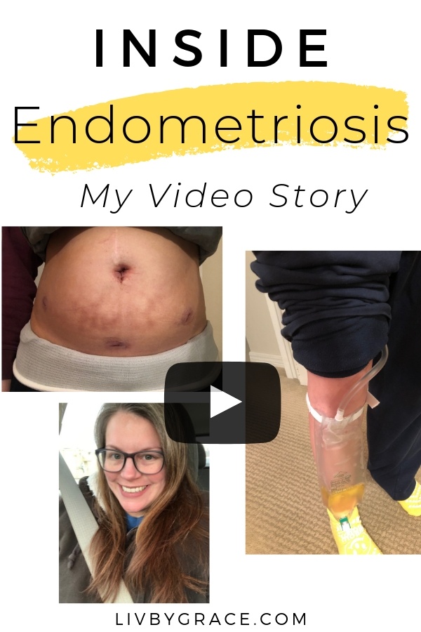 🎥 Inside Endometriosis: My Video Story